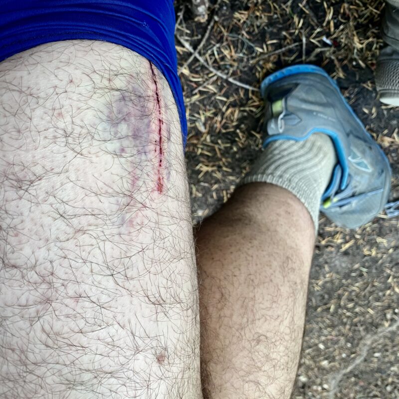Hiker Gash